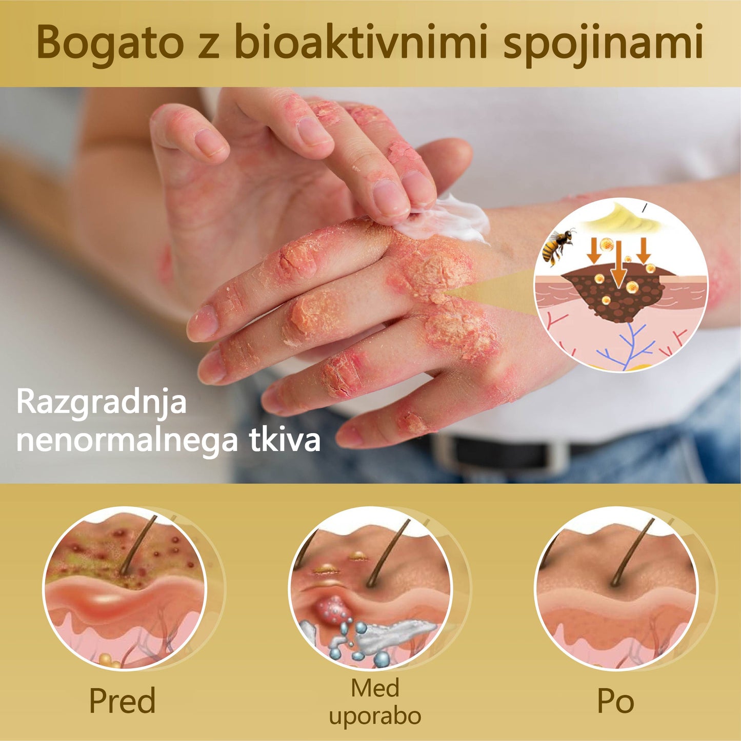 🌟 TOPWAL® Condense Krema za obnovo kože z čebeljim strupom 🌿 Spodbuja regeneracijo kože 💧 Globoko vlaži in neguje ✨ Zmanjšuje drobne gube in linije 🐝 Obogatena z naravnim čebeljim strupom ✔️ Primerna za vse tipe kože, tudi občutljivo