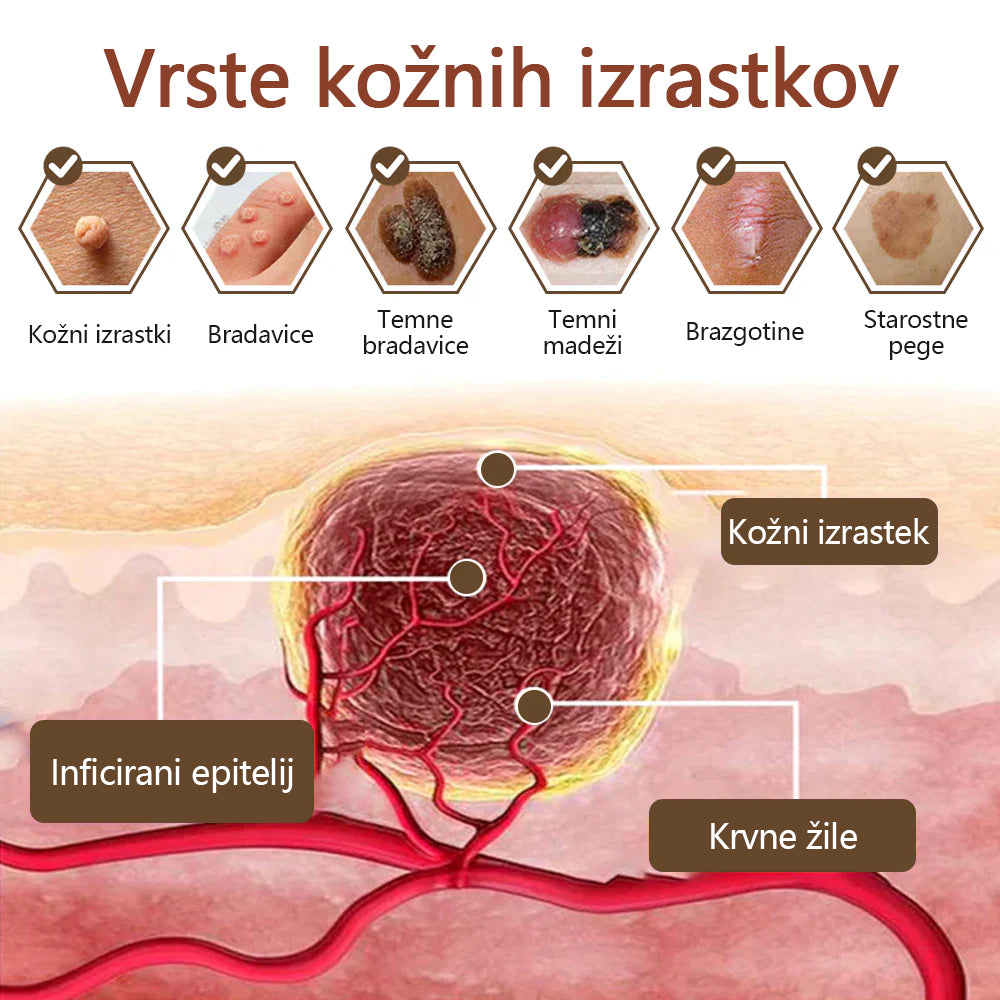 Zvoevo® Black Rice Skin Repair Essence Cream ⚕️ Certificirano pri EU (Odstranjuje bradavice in kožne izrastke, lajša luskavico, izboljšuje kopičenje keratina in folikularno keratinizacijo, posvetli pigmentacijo, sončne pege in starostne pege)