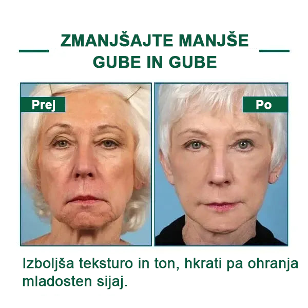 🌿Osvežite kožo v samo treh dneh💝𝙁𝙪𝙗𝙨𝙩𝙖™ pomlajevalni in učvrstitveni serum🔥