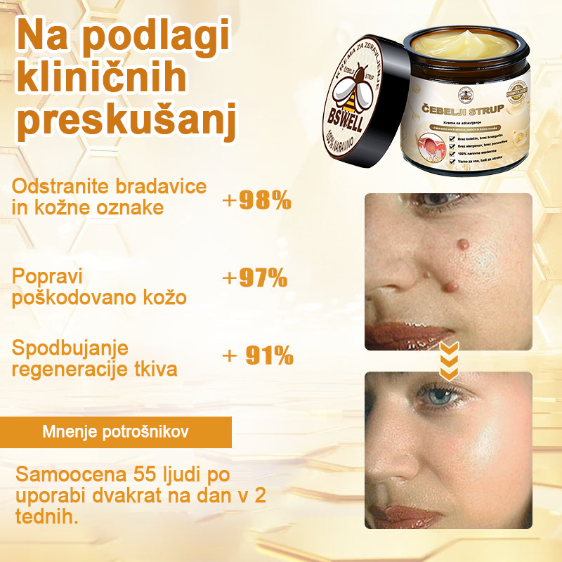🐝✨𝑩𝑺𝑾𝑬𝑳𝑳® Krema za nego kože z čebeljim strupom👨⚕️ (Priporočena s strani AAD) (🔥 Zadnji dan promocije, prihranite 70%)