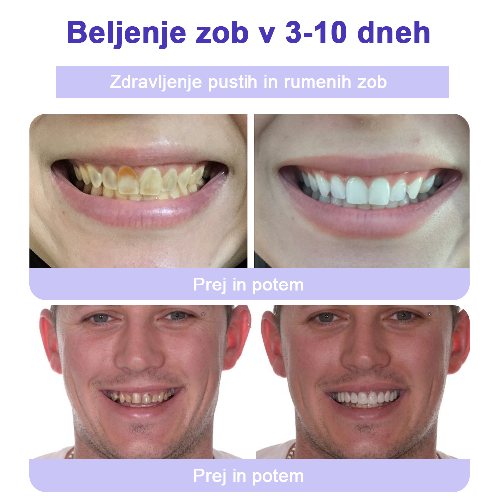GarageLine™ (priporočeno s strani ADA) Prah za obnovo zobne sklenine (⏰𝐋𝐢𝐦𝐢𝐭𝐚𝐧𝐨 𝐝𝐨𝐥𝐝𝐚𝐧𝐣𝐚 𝐿𝐚𝐬𝐭 𝟑𝟎 𝐦𝐢𝐧𝐮𝐭) 🪥🦷