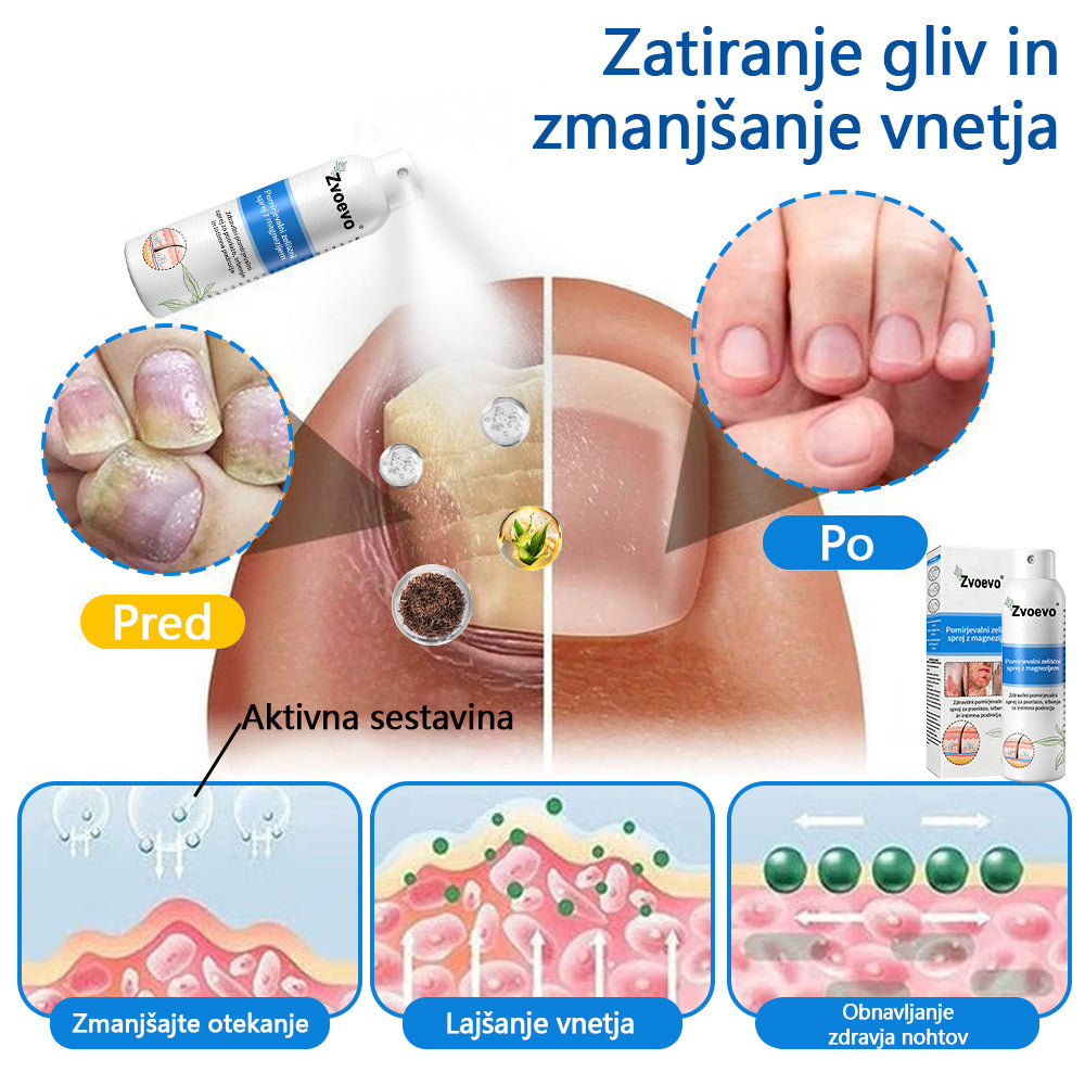 ✅ Uradna trgovina: Zvoevo® Magnezijev zeliščni sprej za luskavico ⚕️ EMA certificirano (lajša luskavico in ekcem, izboljšuje bakterijske okužbe na genitalnem področju, zdravi akne in bradavice, lajša bolečine v sklepih in nevropatske bolečine)