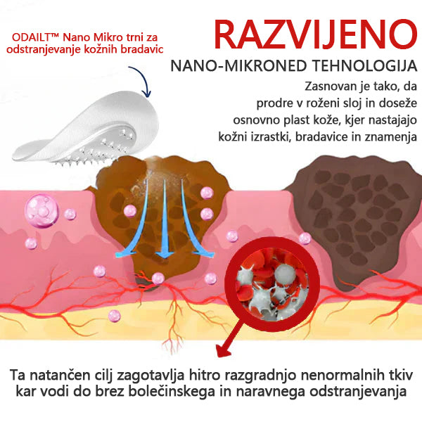 KUBOZN® Nano-mikroigelni obliži – neboleča in naravna rešitev za odstranjevanje kožnih izrastkov, bradavic in znamenj kar doma, brez brazgotin ✨