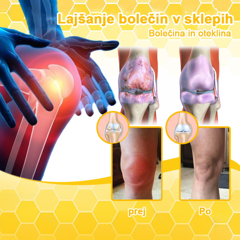 𝐋𝐎𝐕𝐈𝐋𝐃𝐒™ 𝐊𝐫𝐞𝐦𝐚 𝐳𝐚 𝐳𝐝𝐫𝐚𝐯𝐥𝐣𝐞𝐧𝐣𝐞 𝐚𝐫𝐭𝐫𝐢𝐭𝐢𝐬𝐚 𝐳 č𝐞𝐛𝐞𝐥𝐣𝐢𝐦 𝐬𝐭𝐫𝐮𝐩𝐨𝐦 𝐢𝐧 𝐤𝐮𝐫𝐤𝐮𝐦𝐨 (👩🔬 𝐒𝐩𝐞𝐜𝐢𝐚𝐥𝐢𝐳𝐢𝐫𝐚𝐧𝐚 𝐳𝐚 𝐨𝐫𝐭𝐨𝐩𝐞𝐝𝐬𝐤𝐚 𝐬𝐭𝐚𝐧𝐣𝐚 𝐢𝐧 𝐛𝐨𝐥𝐞č𝐢𝐧𝐞 𝐯 𝐬𝐤𝐥𝐞𝐩𝐢𝐡 👩🔬)