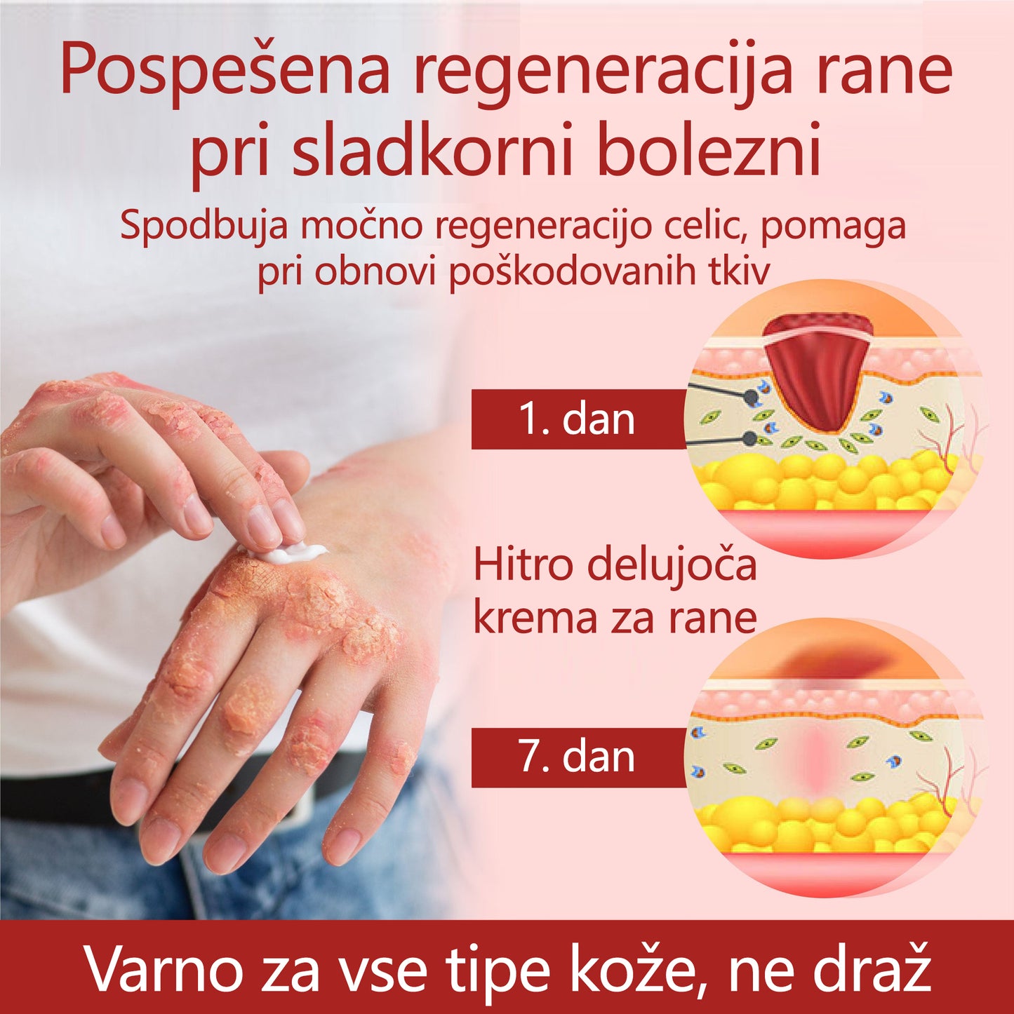 ✨👣 TOPWAL® GlucoseGuard Skin Rescue Krema – Hitrejše celjenje, varnejša zaščita in vsakodnevna hidracija za diabetično kožo 🌿💧