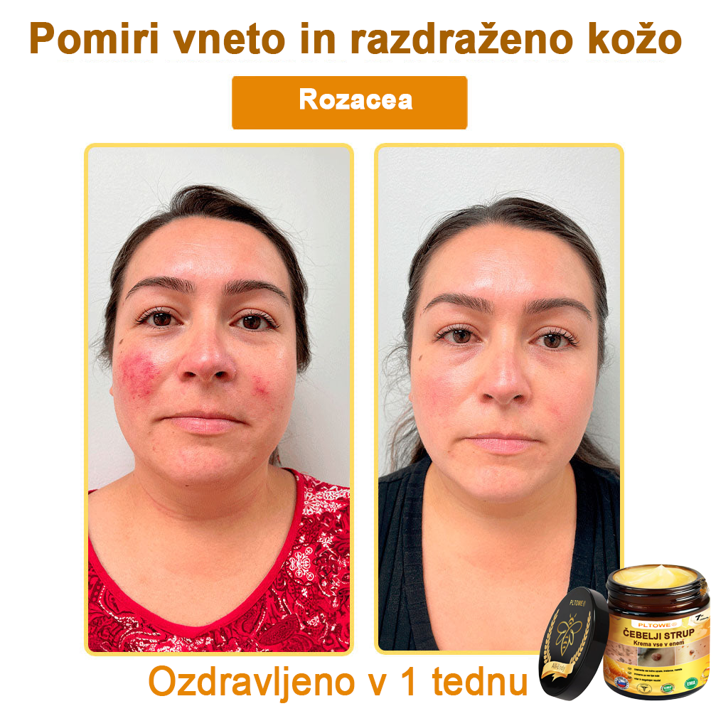 ZADNJA PRILOŽNOST! Zgrabi to srečno najdbo s 70 % Popustom! 🔥180-DNEVNO GARANCIJA VRAČILA DENARJA!