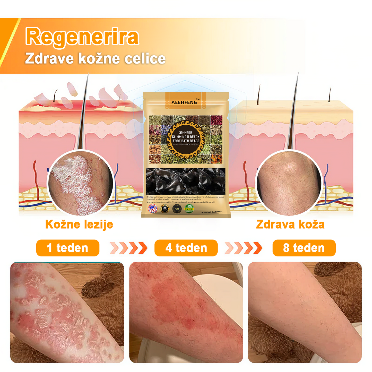 𝐀𝐞𝐞𝐡𝐟𝐞𝐧𝐠™ 𝐙𝐞𝐥𝐢šč𝐧𝐞 𝐫𝐚𝐳𝐬𝐭𝐫𝐮𝐩𝐥𝐣𝐞𝐯𝐚𝐥𝐧𝐞 𝐤𝐫𝐨𝐠𝐥𝐢𝐜𝐞 𝐳𝐚 𝐯𝐞𝐧𝐞 𝐳𝐚 𝐤𝐨𝐩𝐞𝐥 𝐧𝐨𝐠🦵👩⚕️ (LANA Certification, European Lymphology Association)