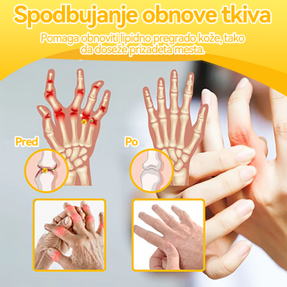 ✅ Uradna trgovina: 𝐒𝐩𝐳𝐯®📦 Č𝐞𝐛𝐞𝐥𝐣𝐢 𝐒𝐭𝐫𝐮𝐩 𝐒𝐤𝐥𝐞𝐩𝐢 & 𝐊𝐨𝐬𝐭𝐢 𝐙𝐝𝐫𝐚𝐯𝐥𝐣𝐞𝐧𝐣𝐞 𝐊𝐫𝐞𝐦𝐚 🐝 (𝐙𝐧𝐚č𝐚𝐣𝐧𝐨 za 𝐨𝐫𝐭𝐨𝐩𝐞𝐝𝐬𝐤𝐞 𝐛𝐨𝐥𝐞𝐳𝐧𝐢 𝐢 𝐛𝐨𝐥𝐞č𝐢𝐧𝐞 𝐩𝐫𝐢 𝐚𝐫𝐭𝐫𝐢𝐭𝐢𝐬𝐮)