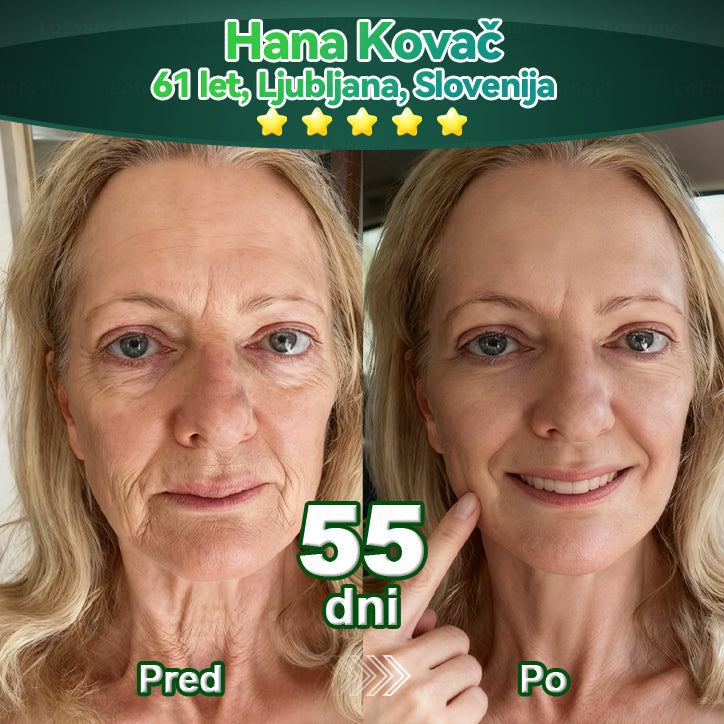 𝐿𝑜𝑡𝑚𝑎𝑦® 𝐾𝑎𝑝𝑙𝑗𝑖𝑐𝑒 𝑧 𝑚𝑎𝑡𝑖č𝑛𝑖𝑚𝑖 𝑐𝑒𝑙𝑖𝑐𝑎𝑚𝑖 𝑖𝑛 𝑘𝑜𝑙𝑎𝑔𝑒𝑛𝑠𝑘𝑖𝑚𝑖 𝑝𝑒𝑝𝑡𝑖𝑑𝑖 💧 (za učvrstitev in dvig povešene kože ter zmanjšanje nastanka gub) ❤️‍🔥