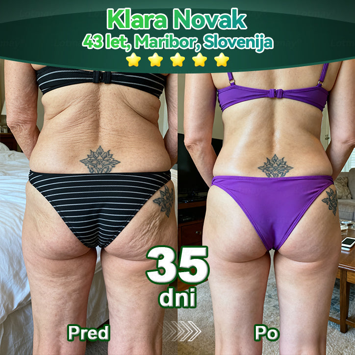 𝐿𝑜𝑡𝑚𝑎𝑦® 𝐾𝑎𝑝𝑙𝑗𝑖𝑐𝑒 𝑧 𝑚𝑎𝑡𝑖č𝑛𝑖𝑚𝑖 𝑐𝑒𝑙𝑖𝑐𝑎𝑚𝑖 𝑖𝑛 𝑘𝑜𝑙𝑎𝑔𝑒𝑛𝑠𝑘𝑖𝑚𝑖 𝑝𝑒𝑝𝑡𝑖𝑑𝑖 💧 (za učvrstitev in dvig povešene kože ter zmanjšanje nastanka gub) ❤️‍🔥