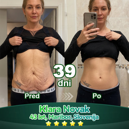 𝐿𝑜𝑡𝑚𝑎𝑦® 𝐾𝑎𝑝𝑙𝑗𝑖𝑐𝑒 𝑧 𝑚𝑎𝑡𝑖č𝑛𝑖𝑚𝑖 𝑐𝑒𝑙𝑖𝑐𝑎𝑚𝑖 𝑖𝑛 𝑘𝑜𝑙𝑎𝑔𝑒𝑛𝑠𝑘𝑖𝑚𝑖 𝑝𝑒𝑝𝑡𝑖𝑑𝑖 💧 (za učvrstitev in dvig povešene kože ter zmanjšanje nastanka gub) ❤️‍🔥