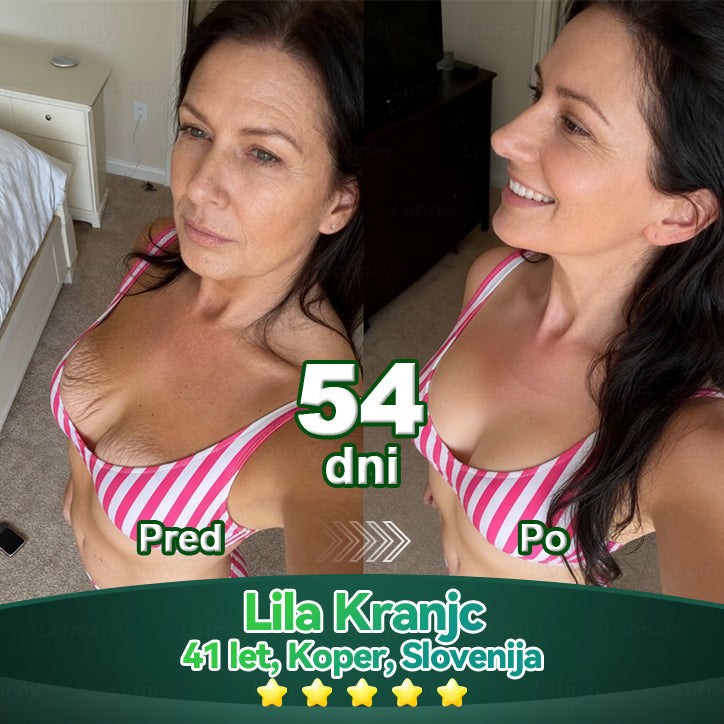 𝐿𝑜𝑡𝑚𝑎𝑦® 𝐾𝑎𝑝𝑙𝑗𝑖𝑐𝑒 𝑧 𝑚𝑎𝑡𝑖č𝑛𝑖𝑚𝑖 𝑐𝑒𝑙𝑖𝑐𝑎𝑚𝑖 𝑖𝑛 𝑘𝑜𝑙𝑎𝑔𝑒𝑛𝑠𝑘𝑖𝑚𝑖 𝑝𝑒𝑝𝑡𝑖𝑑𝑖 💧 (za učvrstitev in dvig povešene kože ter zmanjšanje nastanka gub) ❤️‍🔥