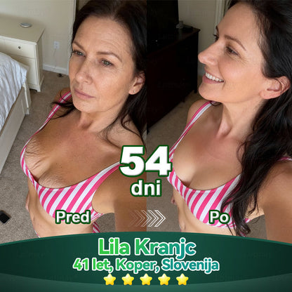 𝐿𝑜𝑡𝑚𝑎𝑦® 𝐾𝑎𝑝𝑙𝑗𝑖𝑐𝑒 𝑧 𝑚𝑎𝑡𝑖č𝑛𝑖𝑚𝑖 𝑐𝑒𝑙𝑖𝑐𝑎𝑚𝑖 𝑖𝑛 𝑘𝑜𝑙𝑎𝑔𝑒𝑛𝑠𝑘𝑖𝑚𝑖 𝑝𝑒𝑝𝑡𝑖𝑑𝑖 💧 (za učvrstitev in dvig povešene kože ter zmanjšanje nastanka gub) ❤️‍🔥