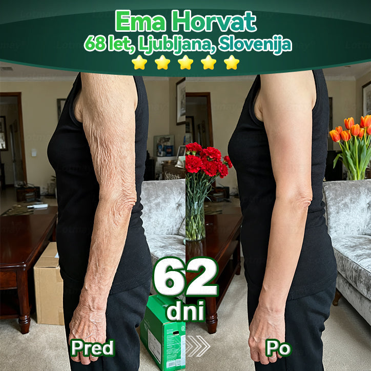 𝐿𝑜𝑡𝑚𝑎𝑦® 𝐾𝑎𝑝𝑙𝑗𝑖𝑐𝑒 𝑧 𝑚𝑎𝑡𝑖č𝑛𝑖𝑚𝑖 𝑐𝑒𝑙𝑖𝑐𝑎𝑚𝑖 𝑖𝑛 𝑘𝑜𝑙𝑎𝑔𝑒𝑛𝑠𝑘𝑖𝑚𝑖 𝑝𝑒𝑝𝑡𝑖𝑑𝑖 💧 (za učvrstitev in dvig povešene kože ter zmanjšanje nastanka gub) ❤️‍🔥