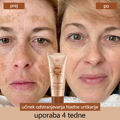 Parowu™ Belilna in Odstranjevalna Maska za madeže - 🍀 Naravne sestavine trajno odstranjujejo pigmentne madeže, starostne pege, pegice in sončne madeže 🔥