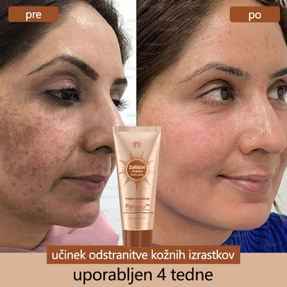 Parowu™ Belilna in Odstranjevalna Maska za madeže - 🍀 Naravne sestavine trajno odstranjujejo pigmentne madeže, starostne pege, pegice in sončne madeže 🔥