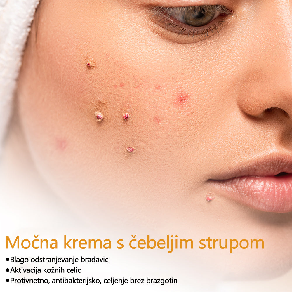 🐝Twinsun™ Izjemno Močna Krema z Čebeljim Strupom, s certifikatom EMA💖 Za zdravljenje bradavic, kožnih izrastkov, okužb in keratoze, ter za glajenje neenakomerne kože