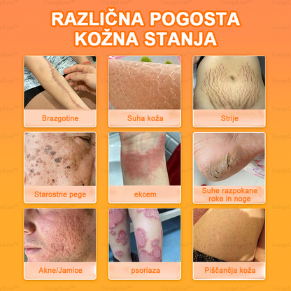 [Uradna trgovina blagovnih znamk🎉] Nova terapevtska krema s konjskim oljem 2025