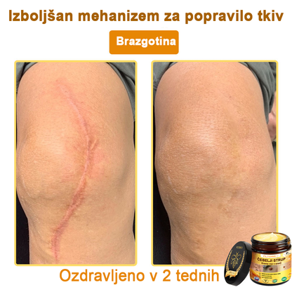 ZADNJA PRILOŽNOST! Zgrabi to srečno najdbo s 70 % Popustom! 🔥180-DNEVNO GARANCIJA VRAČILA DENARJA!