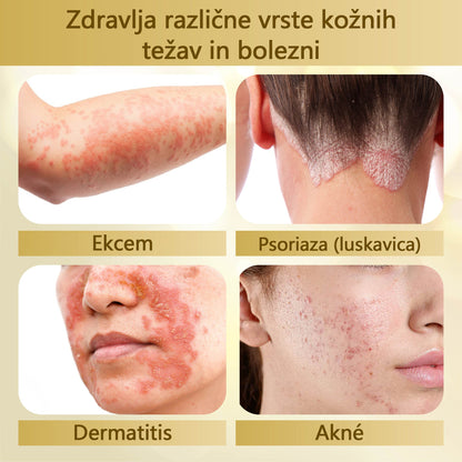 🌟 TOPWAL® Condense Krema za obnovo kože z čebeljim strupom 🌿 Spodbuja regeneracijo kože 💧 Globoko vlaži in neguje ✨ Zmanjšuje drobne gube in linije 🐝 Obogatena z naravnim čebeljim strupom ✔️ Primerna za vse tipe kože, tudi občutljivo