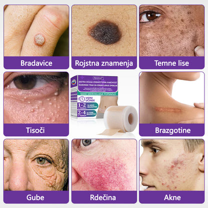🏷️ Uradna Trgovina: flysmus® ReGen Mikronadlaste Ploščice z Nano-Hialuronsko Kislino (Nano-Heal) 💝 Zdravljenje novih in starih brazgotin, zmanjševanje kirurških brazgotin, strij, keloidov, aken, opeklin, bradavic, dermatomov in krčnih žil