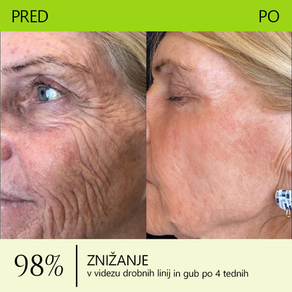 👩🏻‍⚕️🎁𝗥𝗲𝗴𝗮𝗶𝗻 𝘆𝗼𝘂𝘁𝗵𝗳𝘂𝗹 𝘀𝗸𝗶𝗻 𝗻𝗼𝘄𝗻🌌𝗦𝗧𝗗𝗘𝗜® 𝗕𝗢𝗧𝗢𝗫 & 𝗩𝗜𝗧𝗔𝗠𝗜𝗡 𝗔 𝗥𝗘𝗧𝗜𝗡𝗢𝗟 𝗜𝗡𝗝𝗘𝗞𝗖𝗜𝗝𝗔 𝗚𝘂𝗯𝗮𝗻𝗷𝗲𝗺 𝗗𝘃𝗶𝗴𝗼𝘃𝗮𝗻𝗷𝗲 𝗭𝗮𝘁𝗲𝘇𝗼𝘃𝗮𝗻𝗷𝗲 𝗦𝗺𝗲𝘁𝗮𝗻𝗮