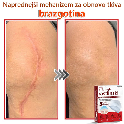 👨‍⚕️ GFOUK® MicroNeedle obliž za odstranjevanje kožnih izrastkov 🇪🇺 Skupno z EU smernicami za nego kože