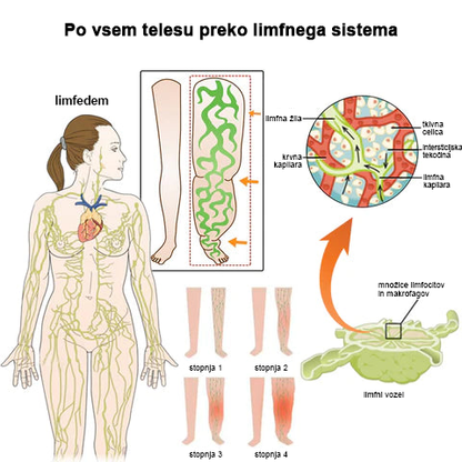 🐝𝙇𝙪𝙠𝙢𝙡𝙘𝙖™ kroglice za limfno drenažo s čebeljim strupom in namakanje stopal🫚