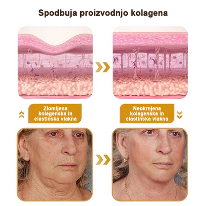 🍀 Zadnji dan promocije: 83 % popust ✨𝐅𝐮𝐫𝐳𝐞𝐫𝐨™ Kremni odstranjevalec gub z čebeljim strupom in botoks učinkom🐝