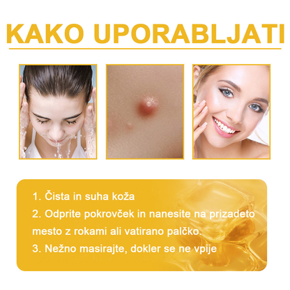 ✨🎁𝑭𝑹𝑶𝑷𝑼𝑵™ krema za odstranjevanje znamenj in madežev (85% popust zadnji dan dogodka)