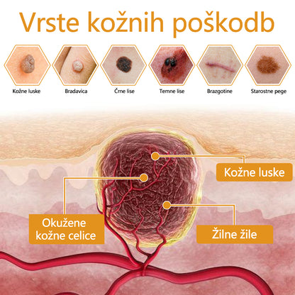 🐝Twinsun™ Izjemno Močna Krema z Čebeljim Strupom, s certifikatom EMA💖 Za zdravljenje bradavic, kožnih izrastkov, okužb in keratoze, ter za glajenje neenakomerne kože
