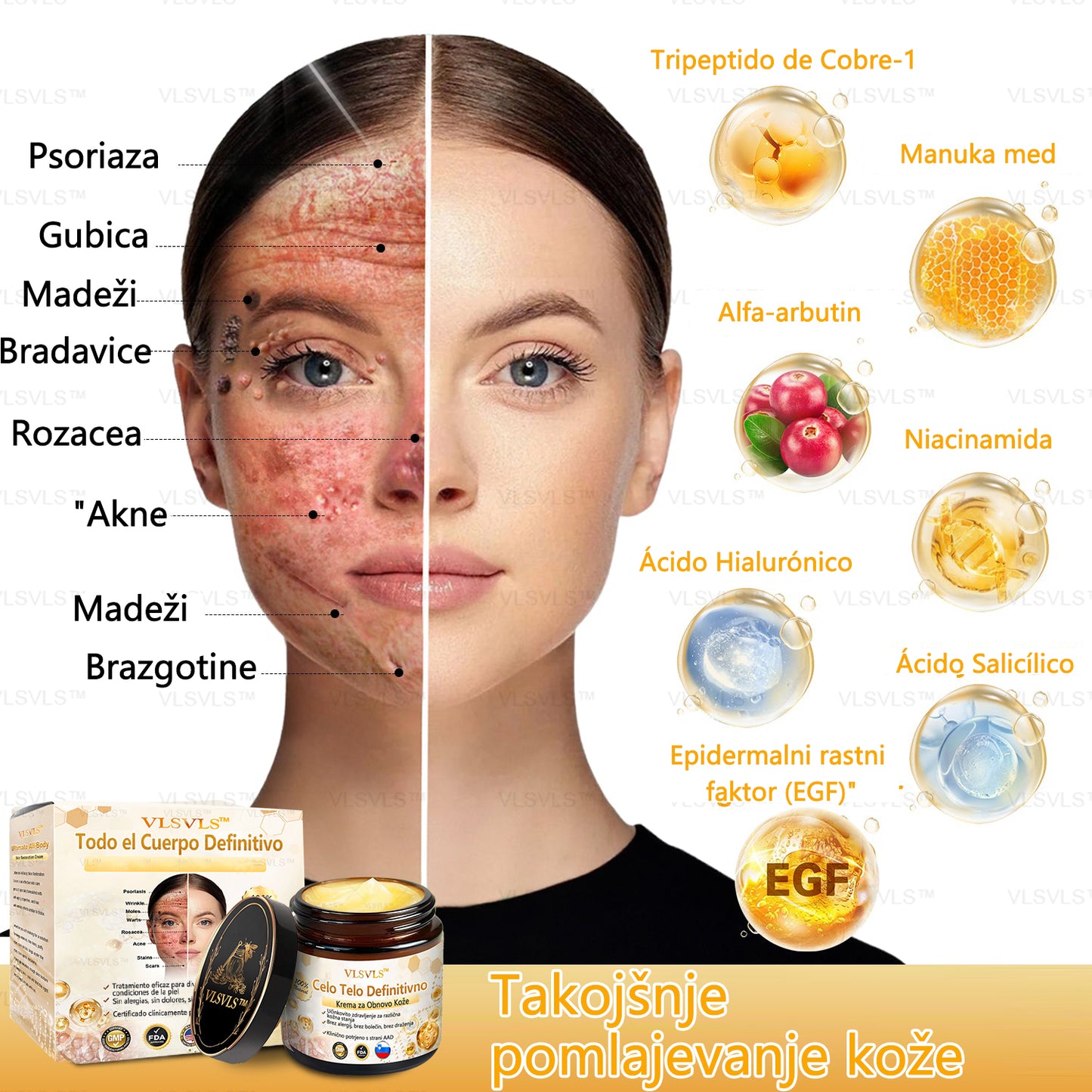 𝐕𝐋𝐒𝐕𝐋𝐒™ 𝐊𝐫𝐞𝐦𝐚 𝐳𝐚 𝐨𝐛𝐧𝐨𝐯𝐨 𝐤𝐨ž𝐞 𝐜𝐞𝐥𝐨𝐭𝐧𝐞𝐠𝐚 𝐭𝐞𝐥𝐞𝐬𝐚 – (🧑‍⚕️ Strokovno priporočilo 🤩 Dobitnik nagrade Readers' Choice Award 2024)