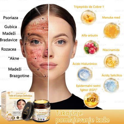 𝐕𝐋𝐒𝐕𝐋𝐒™ 𝐊𝐫𝐞𝐦𝐚 𝐳𝐚 𝐨𝐛𝐧𝐨𝐯𝐨 𝐤𝐨ž𝐞 𝐜𝐞𝐥𝐨𝐭𝐧𝐞𝐠𝐚 𝐭𝐞𝐥𝐞𝐬𝐚 – (🧑‍⚕️ Strokovno priporočilo 🤩 Dobitnik nagrade Readers' Choice Award 2024)