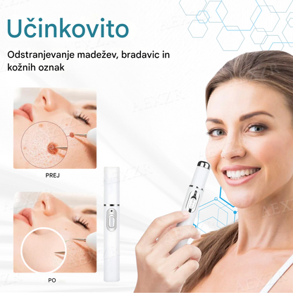 Bikenda® neinvazivno lasersko pero za odstranjevanje madežev in bradavic
