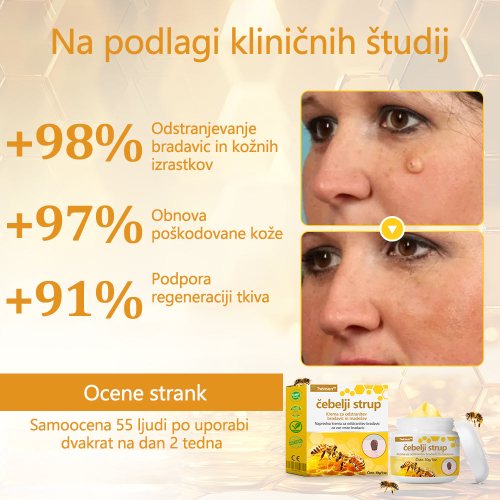 🐝Twinsun™ Izjemno Močna Krema z Čebeljim Strupom, s certifikatom EMA💖 Za zdravljenje bradavic, kožnih izrastkov, okužb in keratoze, ter za glajenje neenakomerne kože
