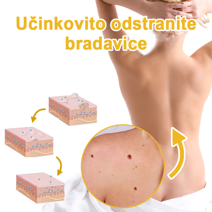 ✨🎁𝑭𝑹𝑶𝑷𝑼𝑵™ krema za odstranjevanje znamenj in madežev (85% popust zadnji dan dogodka)