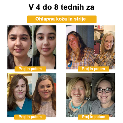 🍀🎈𝐅𝐑𝐎𝐏𝐔𝐍™ Čebelji strup Limfna drenaža obliž za hujšanje (Za vse limfatične težave in debelost)