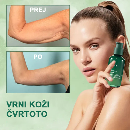 🌿Osvežite kožo v samo treh dneh💝𝙁𝙪𝙗𝙨𝙩𝙖™ pomlajevalni in učvrstitveni serum🔥