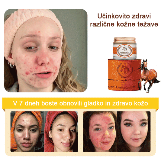 [Uradna trgovina blagovnih znamk🎉] Nova terapevtska krema s konjskim oljem 2025