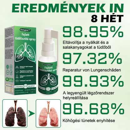 🍀 𝐆𝐨𝐨𝐲𝐞𝐞𝐫™ napreden sprej za čiščenje pljuč – podpira zdravje pljuč, bronhijev in nosnih votlin, spodbuja zdravje dihalnega sistema in lažje dihanje.