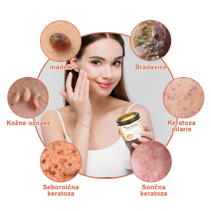 🍊𝑻𝒖𝒓𝒐𝒏𝒖™ Zdravilno mazilo s čebeljim strupom (👨‍⚕𝐀𝐀𝐃 PRIPOROČILA)