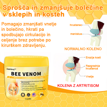 👩‍⚕️👩‍⚕️𝐀ее𝐡𝐟𝐧𝐠™ Krema s čebeljim strupom za napredno terapijo sklepov in kosti (izvleček novozelandske čebele - specializirano za ortopedske in artritisne bolečine)