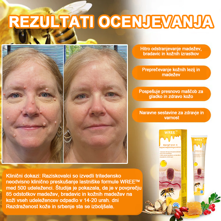 🌺𝙒𝙍𝙀𝙀™ Krema za odstranjevanje bradavic in oznak s čebeljim strupom (👨‍⚕Primerna za vse tipe kože)🐝(🔥Promocija zadnji dan 70% popust)