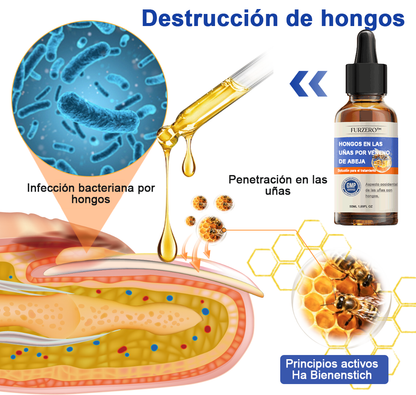 🐝🐝𝐅𝐮𝐫𝐳𝐞𝐫𝐨™Bienengift Nagelpilz Tretma: Popolna rešitev problema glivic na nohtih🌟👣