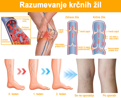 【✨Plačilo po povzetju✨】𝙁𝙪𝙧𝙯𝙚𝙧𝙤™ Pršilo za krčne žile s čebeljim strupom 🐝