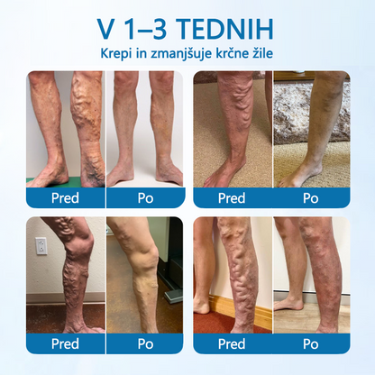 💚Trimil® VeinGuard zeliščni sprej – ✅ Klinično dokazano, da odpravi krčne žile že v 7 dneh! (potrjeno s strani Evropske agencije za zdravila – EMA)