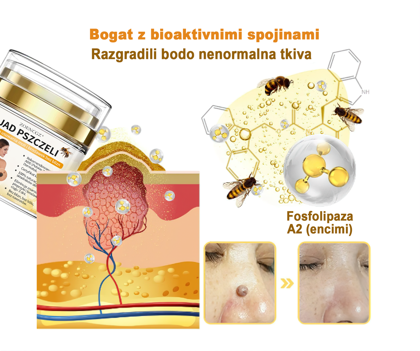 ✨𝐙𝐨𝐞𝐧𝐜𝐠𝐳™ krema s čebeljim strupom za znamenja in bradavice🔥