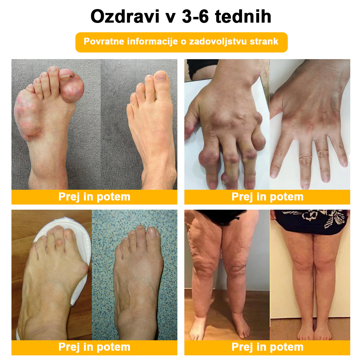 𝐋𝐎𝐕𝐈𝐋𝐃𝐒™ 𝐊𝐫𝐞𝐦𝐚 𝐳𝐚 𝐳𝐝𝐫𝐚𝐯𝐥𝐣𝐞𝐧𝐣𝐞 𝐚𝐫𝐭𝐫𝐢𝐭𝐢𝐬𝐚 𝐳 č𝐞𝐛𝐞𝐥𝐣𝐢𝐦 𝐬𝐭𝐫𝐮𝐩𝐨𝐦 𝐢𝐧 𝐤𝐮𝐫𝐤𝐮𝐦𝐨 (👩‍🔬 𝐒𝐩𝐞𝐜𝐢𝐚𝐥𝐢𝐳𝐢𝐫𝐚𝐧𝐚 𝐳𝐚 𝐨𝐫𝐭𝐨𝐩𝐞𝐝𝐬𝐤𝐚 𝐬𝐭𝐚𝐧𝐣𝐚 𝐢𝐧 𝐛𝐨𝐥𝐞č𝐢𝐧𝐞 𝐯 𝐬𝐤𝐥𝐞𝐩𝐢𝐡 👩‍🔬)