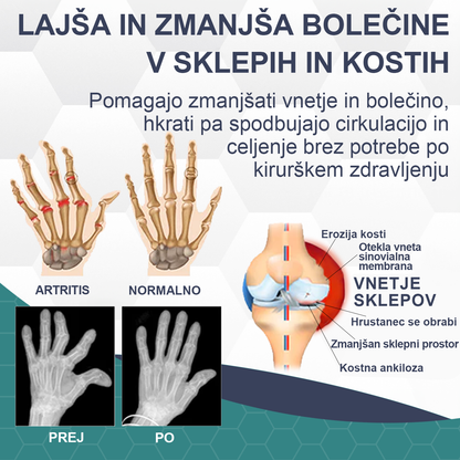🌈🌈𝐓𝐎𝐃𝐀𝐇𝐎𝐅™ Krema za lajšanje bolečin in celjenje kosti s čebeljim strupom🔥Primerno za vse starosti💎 Časovno omejeno 60 % popusta💎