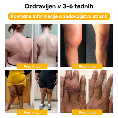 ✅ Uradna trgovina: 𝐒𝐩𝐳𝐯®📦 Č𝐞𝐛𝐞𝐥𝐣𝐢 𝐒𝐭𝐫𝐮𝐩 𝐒𝐤𝐥𝐞𝐩𝐢 & 𝐊𝐨𝐬𝐭𝐢 𝐙𝐝𝐫𝐚𝐯𝐥𝐣𝐞𝐧𝐣𝐞 𝐊𝐫𝐞𝐦𝐚 🐝 (𝐙𝐧𝐚č𝐚𝐣𝐧𝐨 za 𝐨𝐫𝐭𝐨𝐩𝐞𝐝𝐬𝐤𝐞 𝐛𝐨𝐥𝐞𝐳𝐧𝐢 𝐢 𝐛𝐨𝐥𝐞č𝐢𝐧𝐞 𝐩𝐫𝐢 𝐚𝐫𝐭𝐫𝐢𝐭𝐢𝐬𝐮)